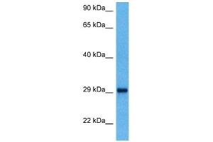 Host:  Mouse  Target Name:  YWHAQ  Sample Tissue:  Mouse Kidney  Antibody Dilution:  1ug/ml (14-3-3 theta Antikörper  (N-Term))