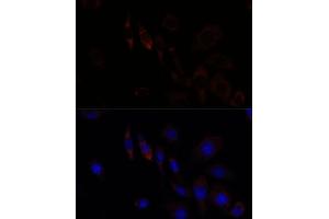 Immunofluorescence (IF) image for anti-Ring Finger Protein 112 (RNF112) (AA 200-500) antibody (ABIN7270054)