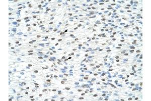Matrin 3 antibody was used for immunohistochemistry at a concentration of 4-8 ug/ml to stain Myocardial cells (arrows) in Human Heart.