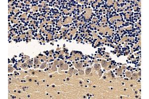 ABIN7094065 and ABIN7098109 at 1/100 staining mouse brain tissue by IHC-P. (AP2B1 Antikörper  (N-Term))