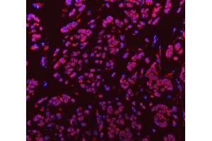 IF analysis of Sm-D3/SNRPD3 using anti-Sm-D3/SNRPD3 antibody (ABIN7598952).