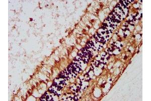 IHC image of ABIN7157984 diluted at 1:200 and staining in paraffin-embedded human eye tissue performed on a Leica BondTM system. (Mip (AA 220-263) Antikörper)