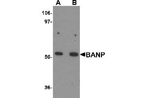 Western Blotting (WB) image for anti-Protein BANP (BANP) (Middle Region) antibody (ABIN1030879)