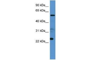 Human 721_B; WB Suggested Anti-CPNE9 Antibody Titration: 0. (CPNE9 Antikörper  (C-Term))