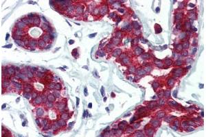 Human Breast (formalin-fixed, paraffin-embedded) stained with TPD52L1 antibody ABIN364314 at 5 ug/ml followed by biotinylated anti-mouse IgG secondary antibody ABIN481714, alkaline phosphatase-streptavidin and chromogen. (TPD52L1 Antikörper)