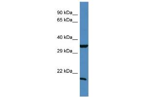Western Blotting (WB) image for anti-TIMP Metallopeptidase Inhibitor 1 (TIMP1) (N-Term) antibody (ABIN2787966)