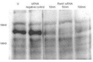 Total lysates (50ug per lane) from Hela cells untransfected (U) or transfected with negative siRNA control or Rent1 siRNAs of 10nm, 50nm to 100nm. (RENT1/UPF1 Antikörper  (AA 583-612))