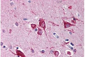 Human Brain, Cortex (formalin-fixed, paraffin-embedded) stained with RHEB antibody ABIN214467 at 5 ug/ml followed by biotinylated goat anti-rabbit IgG secondary antibody ABIN481713, alkaline phosphatase-streptavidin and chromogen. (RHEB Antikörper)