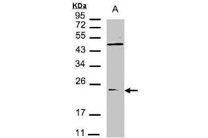 WB Image Sample(30 μg of whole cell lysate) A:293T 12% SDS PAGE antibody diluted at 1:1500
