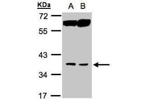 WB Image Sample(30 ug whole cell lysate) A:MOLT4 , B:Raji , 10% SDS PAGE antibody diluted at 1:1000 (ACOT8 Antikörper)
