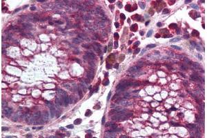 Human Colon (formalin-fixed, paraffin-embedded) stained with NOX1 antibody ABIN297329 at 10 ug/ml followed by biotinylated goat anti-rabbit IgG secondary antibody ABIN481713, alkaline phosphatase-streptavidin and chromogen. (NOX1 Antikörper  (C-Term))