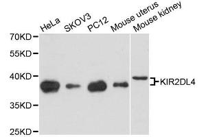 Western blot analysis of extracts of various cell lines, using KIR2DL4 antibody. (KIR2DL4/CD158d Antikörper  (AA 22-242))