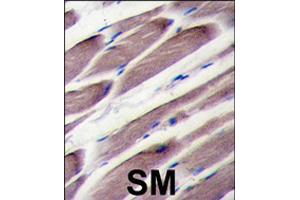 Formalin-fixed and paraffin-embedded human skeletal muscle tissue reacted with LATS2 polyclonal antibody  , which was peroxidase-conjugated to the secondary antibody, followed by DAB staining . (LATS2 Antikörper  (AA 195-224))