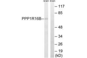Western blot analysis of extracts from mouse brain cells, using PPP1R16B antibody.