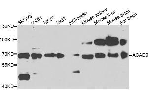 Western blot analysis of extracts of various cells, using ACAD9 antibody. (ACAD9 Antikörper)