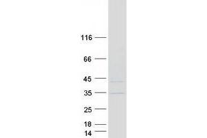 KNSTRN Protein (Transcript Variant 1) (Myc-DYKDDDDK Tag)