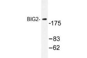 Image no. 1 for anti-ADP-Ribosylation Factor Guanine Nucleotide-Exchange Factor 2 (Brefeldin A-Inhibited) (ARFGEF2) antibody (ABIN317822) (ARFGEF2 Antikörper)