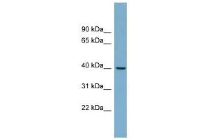 TRIM63 antibody used at 1 ug/ml to detect target protein.