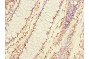 Immunohistochemistry (IHC) image for anti-Tumor Necrosis Factor, alpha-Induced Protein 8 (TNFAIP8) (AA 1-198) antibody (ABIN7173776)