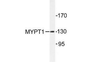 Image no. 1 for anti-Myosin Phosphatase, Target Subunit 1 (PPP1R12A) antibody (ABIN272043) (PPP1R12A Antikörper)