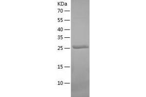 Western Blotting (WB) image for Carbonic Anhydrase VB, Mitochondrial (CA5B) (AA 34-317) protein (His-IF2DI Tag) (ABIN7122131)