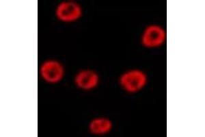 ABIN6279369 staining Hela by IF/ICC. (POLR1E Antikörper  (Internal Region))