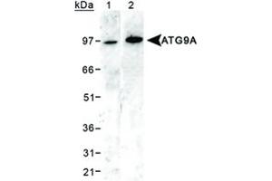 Western blot analysis of ATG9A in 293 cell lysates using ATG9A polyclonal antibody . (ATG9A Antikörper  (AA 750-839))