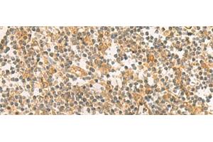 Immunohistochemistry of paraffin-embedded Human tonsil tissue using PPM1M Polyclonal Antibody at dilution of 1:100(x200)