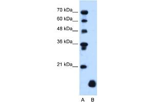 WB Suggested Anti-PLP2 Antibody Titration:  1. (PLP2 Antikörper  (Middle Region))