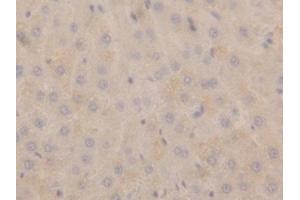Detection of NPPA in Rat Liver Tissue using Polyclonal Antibody to Natriuretic Peptide Precursor A (NPPA) (NPPA Antikörper  (AA 25-152))