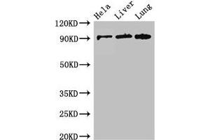 Western Blot Positive WB detected in: Hela whole cell lysate, Mouse liver tissue, Mouse lung tissue All lanes: CPT1C antibody at 2. (CPT1C Antikörper  (AA 699-803))