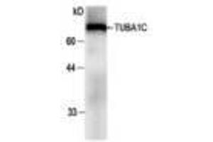 Image no. 1 for anti-Tubulin, alpha 1c (TUBA1C) antibody (ABIN791483) (TUBA1C Antikörper)