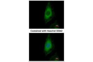ICC/IF Image Immunofluorescence analysis of paraformaldehyde-fixed HeLa, using PP2A beta, antibody at 1:500 dilution. (PPP2CB Antikörper  (Center))