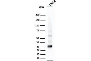 Western Blot Analysis of liver tissue lysate using GSTMu2 Mouse Monoclonal Antibody (CPTC-GSTMu2-2).