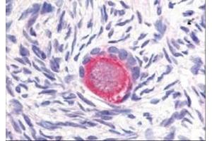 Image no. 1 for anti-delta-Like 4 (DLL4) (Internal Region) antibody (ABIN199951) (DLL4 Antikörper  (Internal Region))