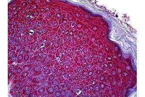 Anti-CCR3 antibody IHC of human skin.