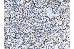 IHC analysis of TRK fused gene/TFG using anti-TRK fused gene/TFG antibody (ABIN7599839). (TFG Antikörper  (AA 121-400))