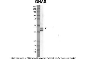 Sample Type: Nthy-ori cell lysate (50ug)Primary Dilution: 1:1000Secondary Antibody: anti-rabbit HRPSecondary Dilution: 1:2000Image Submitted By: Anonymous (GNAS Antikörper  (N-Term))