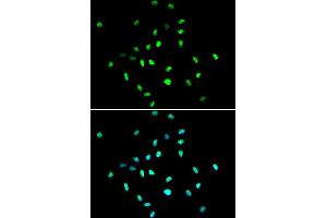 Immunofluorescence analysis of A549 cell using HDAC1 antibody. (HDAC1 Antikörper  (AA 393-482))