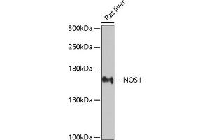 Western blot analysis of extracts of rat liver, using NOS1 antibody (ABIN3022008, ABIN3022009, ABIN3022010 and ABIN6218566) at 1:2000 dilution. (NOS1 Antikörper  (AA 1-180))