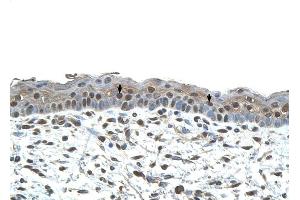 CENPA antibody was used for immunohistochemistry at a concentration of 4-8 ug/ml to stain Squamous epithelial cells (arrows) in Human Skin. (CENPA Antikörper  (N-Term))