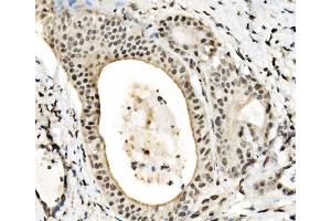 IHC analysis of JUNB using anti-JUNB antibody (ABIN7603223). (JunB Antikörper  (N-Term))