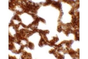 Immunohistochemistry of NETO1 in rat lung tissue with NETO1 antibody at 2. (NETO1 Antikörper  (C-Term))