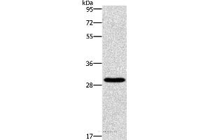 Western blot analysis of Hela cell, using BCL10 Polyclonal Antibody at dilution of 1:950 (BCL10 Antikörper)