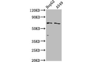 Western Blot Positive WB detected in: HepG2 whole cell lysate, A549 whole cell lysate All lanes: SLCO1B1 antibody at 1:2000 Secondary Goat polyclonal to rabbit IgG at 1/50000 dilution Predicted band size: 77 kDa Observed band size: 77 kDa