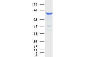 Validation with Western Blot (FE65 Protein (Transcript Variant 1) (Myc-DYKDDDDK Tag))