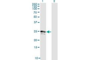 Western Blotting (WB) image for anti-Fibroblast Growth Factor 21 (FGF21) (AA 30-209) antibody (ABIN525693)