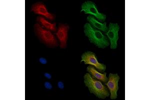ABIN6256556 and ABIN6267493 staining H2O2 treated Hela cells by IF/ICC. (MEK2 Antikörper  (pThr394))