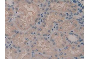 DAB staining on IHC-P; Samples: Human Kidney Tissue (ADCY7 Antikörper  (AA 806-1052))