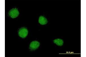 Immunofluorescence of monoclonal antibody to SSX4 on HeLa cell. (SSX4 Antikörper  (AA 91-188))